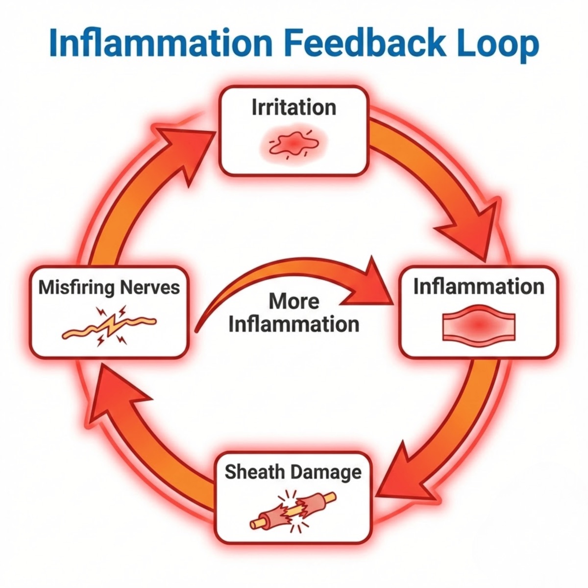 Diagram of the inflammation feedback loop: irritation, inflammation, sheath damage, misfiring nerves